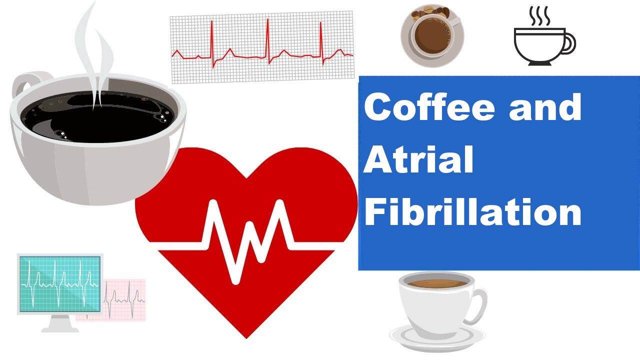 Coffee and Atrial Fibrillation