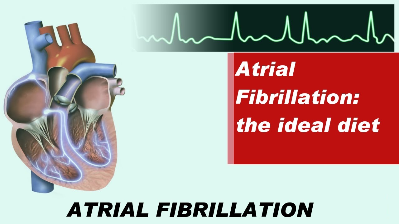 Atrial Fibrillation: the ideal diet