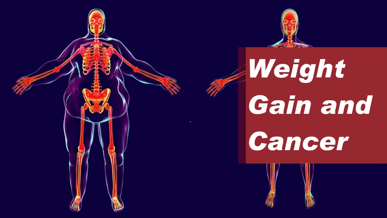 Weight Gain and Cancer