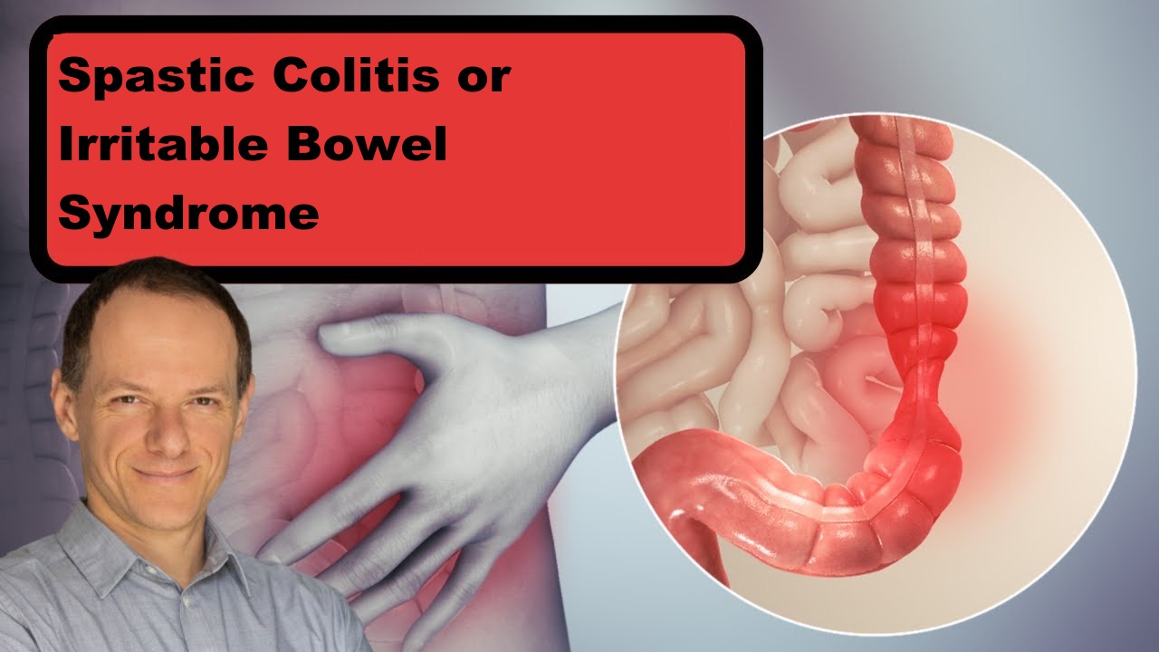 Spastic Colitis or Irritable Bowel Syndrome