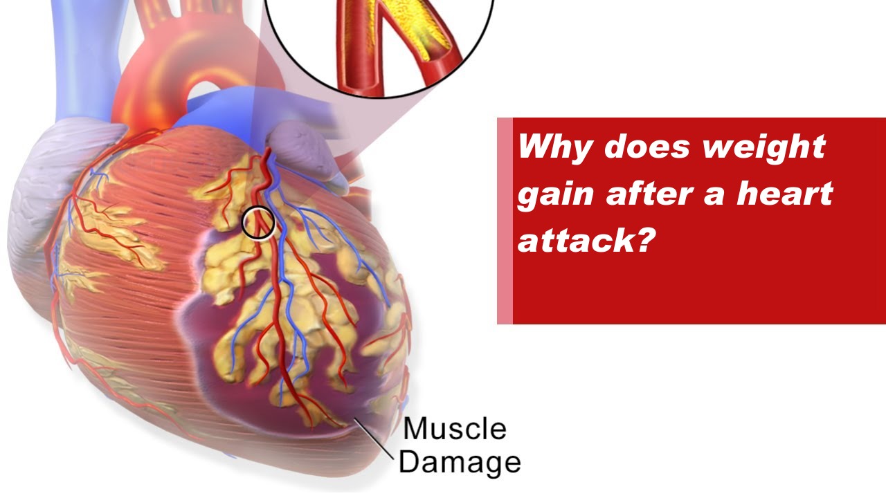 Why does weight gain after a heart attack?