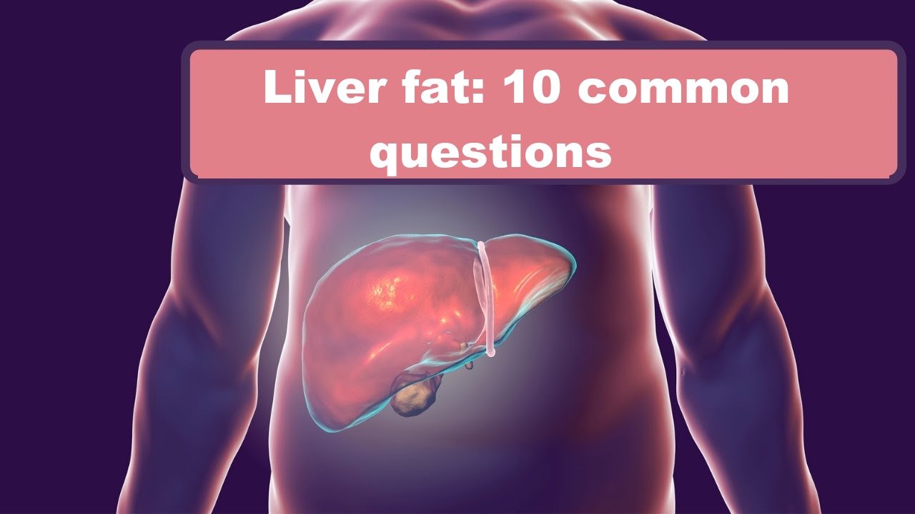 Liver fat: 10 common questions
