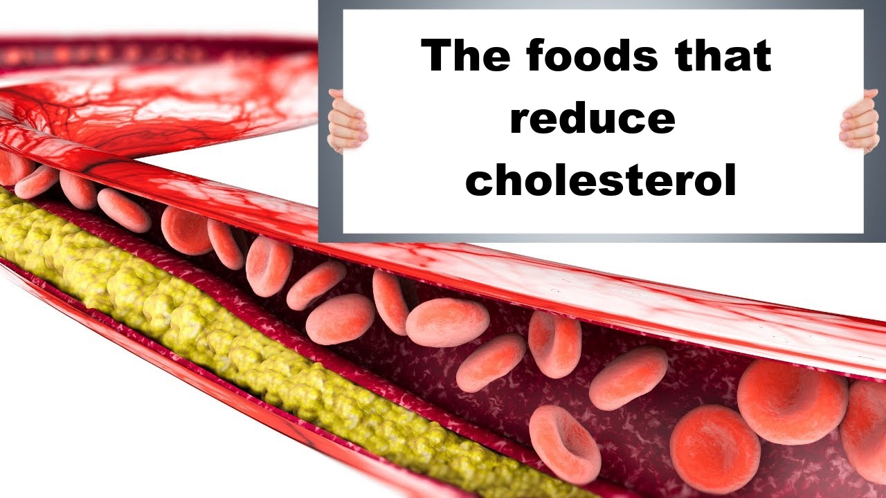 The foods that reduce cholesterol